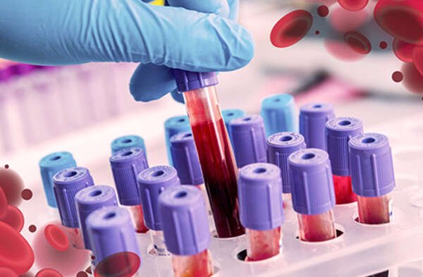 InmunoVet_hematologia